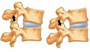 vertebre e dischi intervertebrali