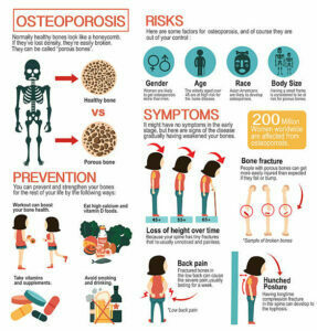 infografica osteoporosi