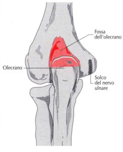 Blocco in estensione