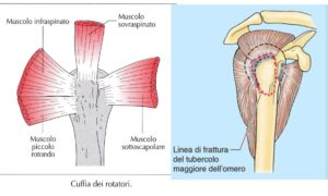 Cuffia rotatori