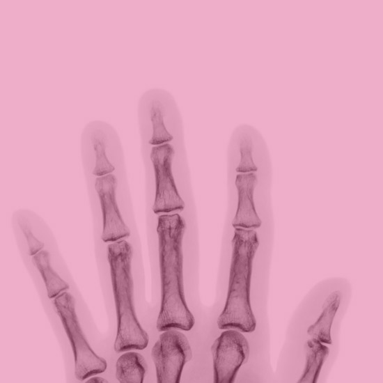 Dettaglio mano raggi X