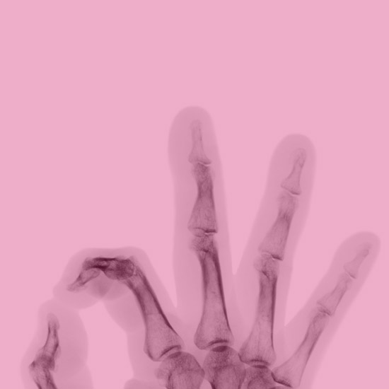 Dettaglio mano raggi X