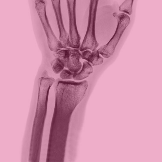 Dettaglio mano raggi X