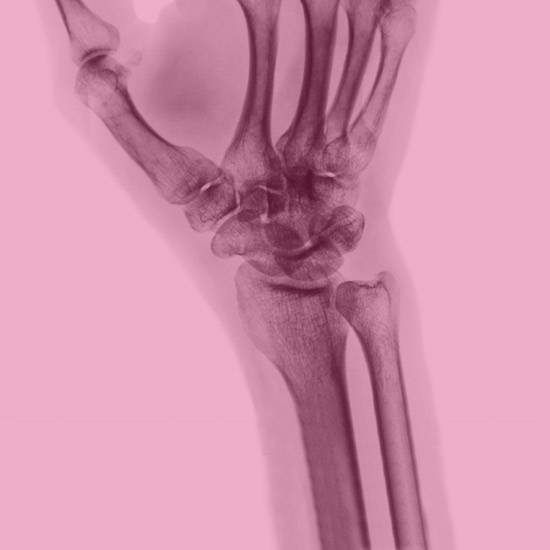 Dettaglio mano raggi X